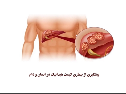 راه های پیشگیری از کیست هیداتید در انسان و دام
